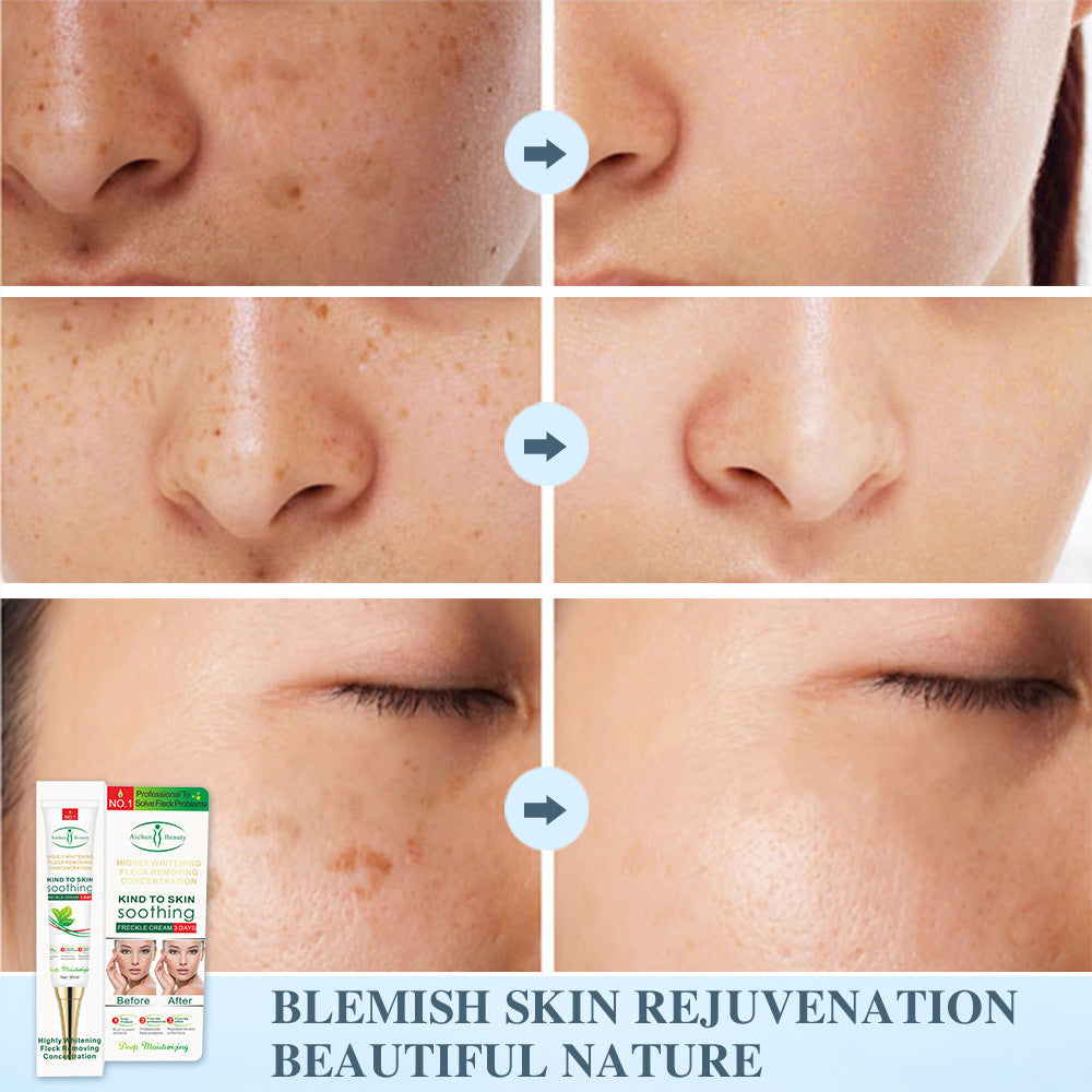 Men And Women Skin Lifting Cosmetics Anti-Spot Cream
